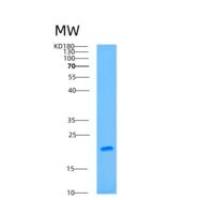 人转录激活因子3(ATF3)重组蛋白