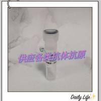 血清淀粉样A蛋白