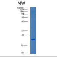 小鼠c型凝集素结构域家族7成员A 1重组蛋白