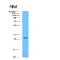 人自噬相关蛋白10(ATG10)重组蛋白