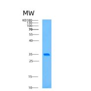 人自噬相关蛋白5(ATG5)重组蛋白
