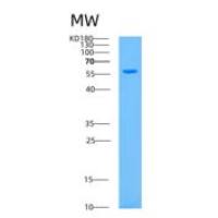 人失调蛋白3(ATXN3)重组蛋白