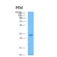 人ATP5C1重组蛋白
