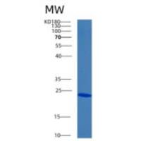 人胆绿素还原酶B重组蛋白