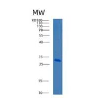 人B-细胞淋巴瘤因子10(Bcl10)重组蛋白