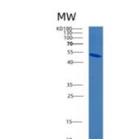 人B-细胞连接蛋白(BLNK)重组蛋白
