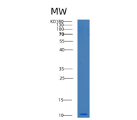 人BTF3L4重组蛋白