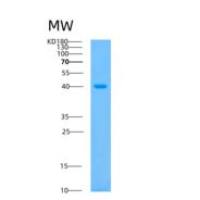 人极光激酶B重组蛋白