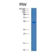 人有丝分裂关卡蛋白BUB3(BUB3)