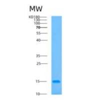 人β2-微球蛋白(b2M)重组蛋白
