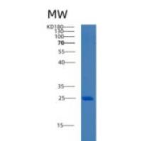 人B-细胞淋巴瘤因子7A(Bcl7A)重组蛋白