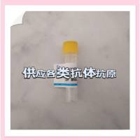 免疫球蛋白A抗原