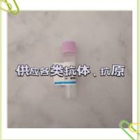 免疫球蛋白M抗原