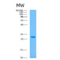 人钠/钾离子转运ATP酶β3肽(ATP1b3)重组蛋白
