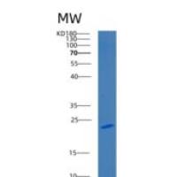 人C9orf103重组蛋白