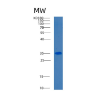 人3-羟基丁酸脱氢酶1(BDH1)重组蛋白