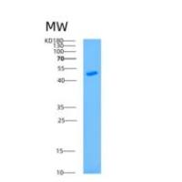 人精氨基琥珀酸合成酶1(ASS1)重组蛋白