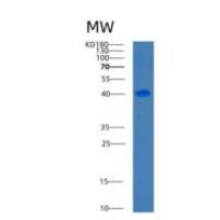 人C1GALT1重组蛋白