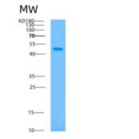 人支链转氨酶1(BCAT1)重组蛋白