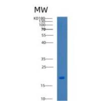人含溴区蛋白1(BRD1)重组蛋白