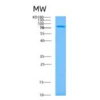 人基底细胞粘附分子(BCAM)重组蛋白