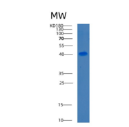 人C1GALT1重组蛋白