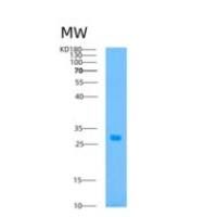 人ATP1B2重组蛋白