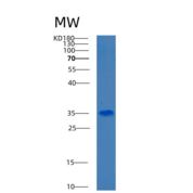 人3-羟基丁酸脱氢酶1(BDH1)重组蛋白