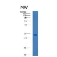 人二磷酸甘油酸变位酶(BPGM)重组蛋白