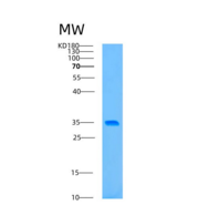 人自噬相关蛋白5(ATG5)重组蛋白