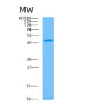 人乳腺癌抗雌激素药物耐药性基因1(BCAR1)重组蛋白
