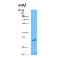 人ATP5F1重组蛋白
