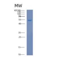人Calnexin重组蛋白