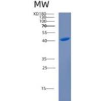 人CAB39L重组蛋白