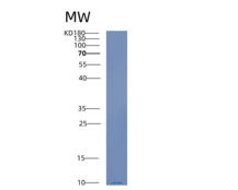 人CAMK2N1重组蛋白