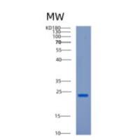 人钙调节配体(CAMLG)重组蛋白