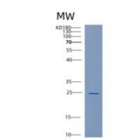 人酪蛋白激酶2β(CK2β) 重组蛋白