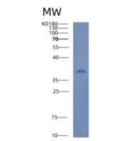 人钙腔蛋白(CALU)重组蛋白