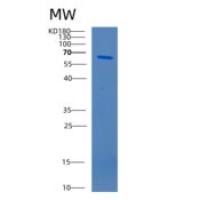 人过氧化氢酶(CAT)重组蛋白