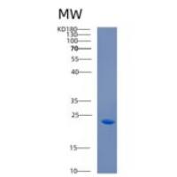 人CABP7重组蛋白