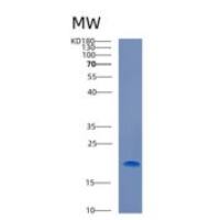 人钙调蛋白样蛋白3(CALML3)重组蛋白