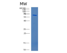 人过氧化氢酶(CAT)重组蛋白
