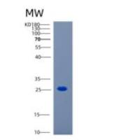 人CAPSL重组蛋白