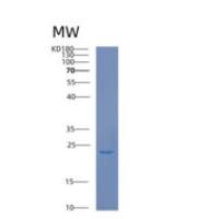 人钙营养蛋白1(CALN1)重组蛋白