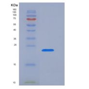 人T-细胞表面糖蛋白CD3ε(CD3e)重组蛋白