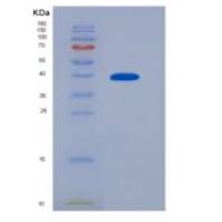 人巨噬细胞来源趋化因子(MDC)重组蛋白