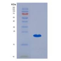 人胸腺表达趋化因子(TECK)重组蛋白