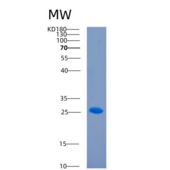 人CD244分子(CD244)重组蛋白