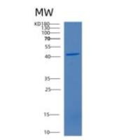 人CD4分子(CD4)重组蛋白