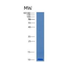 人CCL18重组蛋白